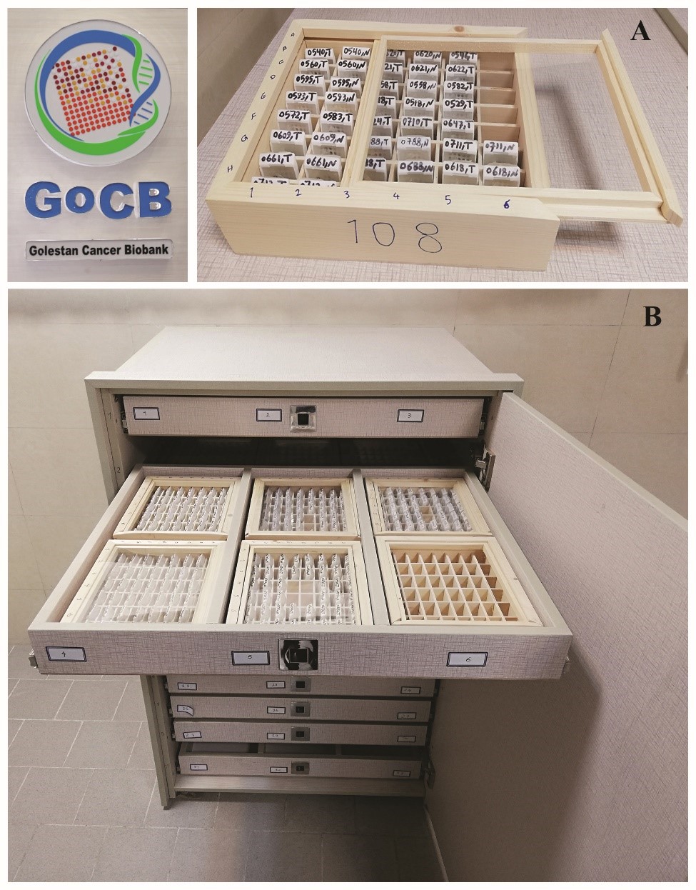 Samples of tissue that have been stored in the Golestan Cancer Biobank